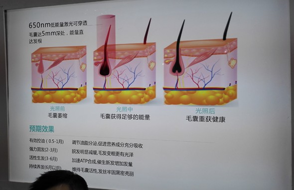 移动医疗展：医疗设备连接云端/在线分析渐成新趋势